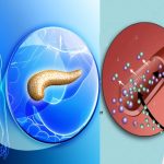 El páncreas y la Diabetes – Tratamiento Especializado