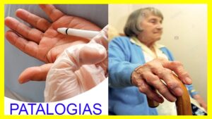 Síntomas de las patologías de la mano: ¿Qué hacer? Nuestras manos siempre están propensas a padecer cualquier accidente que pueda afectar 